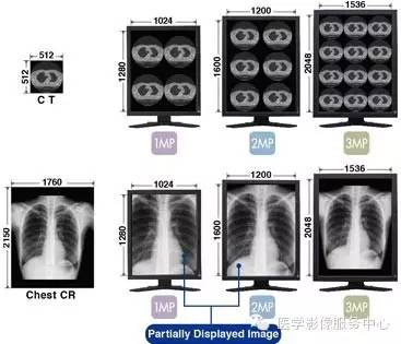 涉足医疗行业必看 医用显示器七大专业指标_行